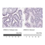 Atlas Antibodies Anti-ARMC4 Antibody
