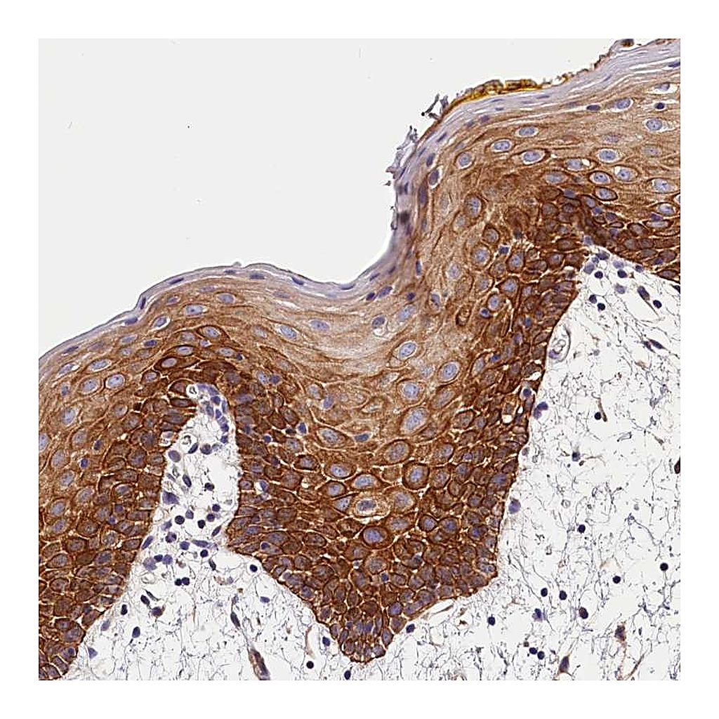 Atlas Antibodies Anti-ARMC6 Antibody