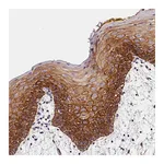 Atlas Antibodies Anti-ARMC6 Antibody
