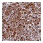 Atlas Antibodies Anti-ARMC6 Antibody