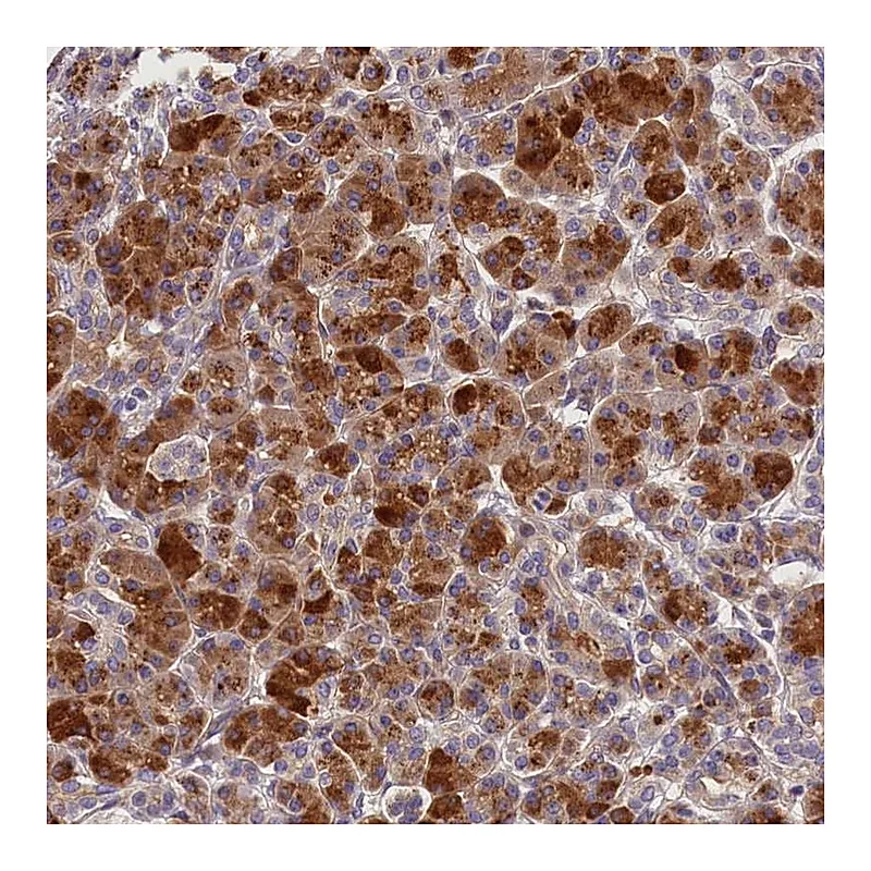 Atlas Antibodies Anti-ARMC6 Antibody