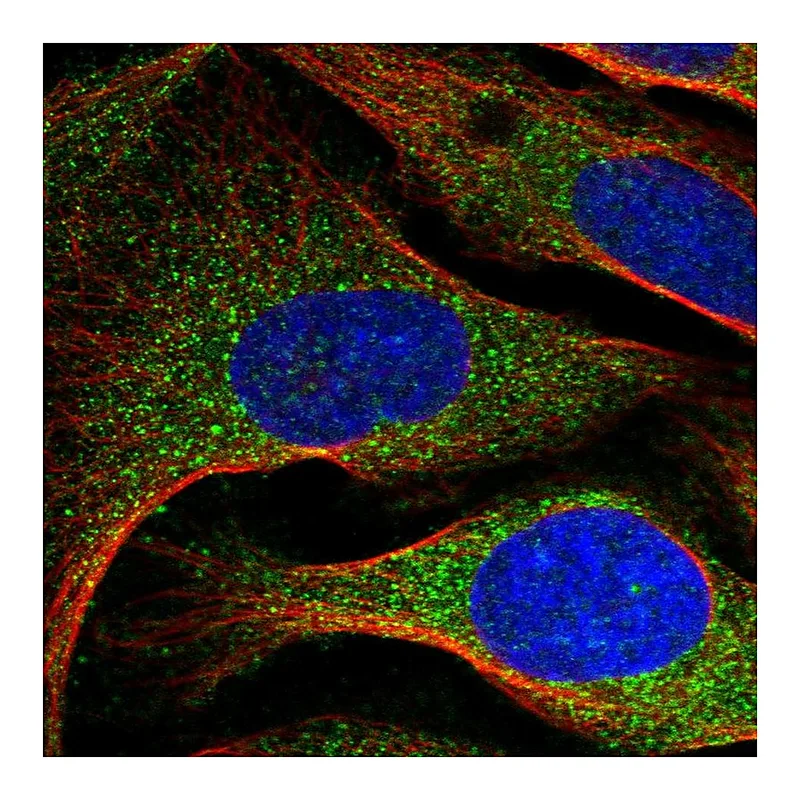 Atlas Antibodies Anti-ARMC7 Antibody