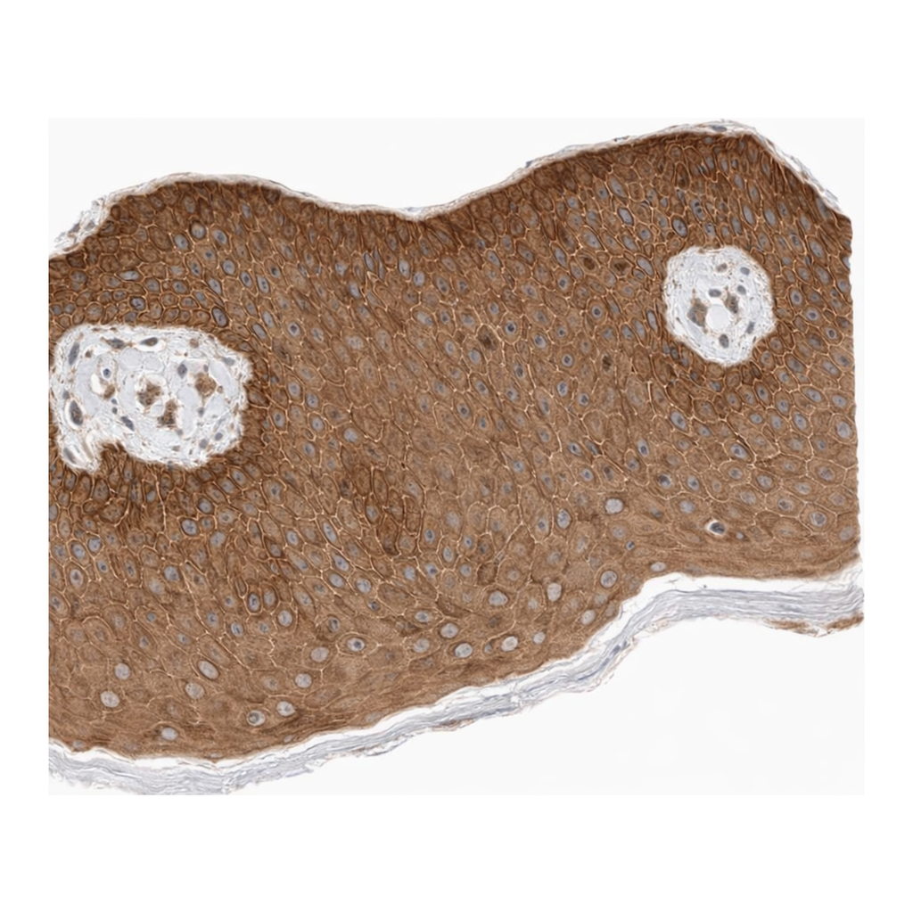 Atlas Antibodies Anti-ARMC9 Antibody