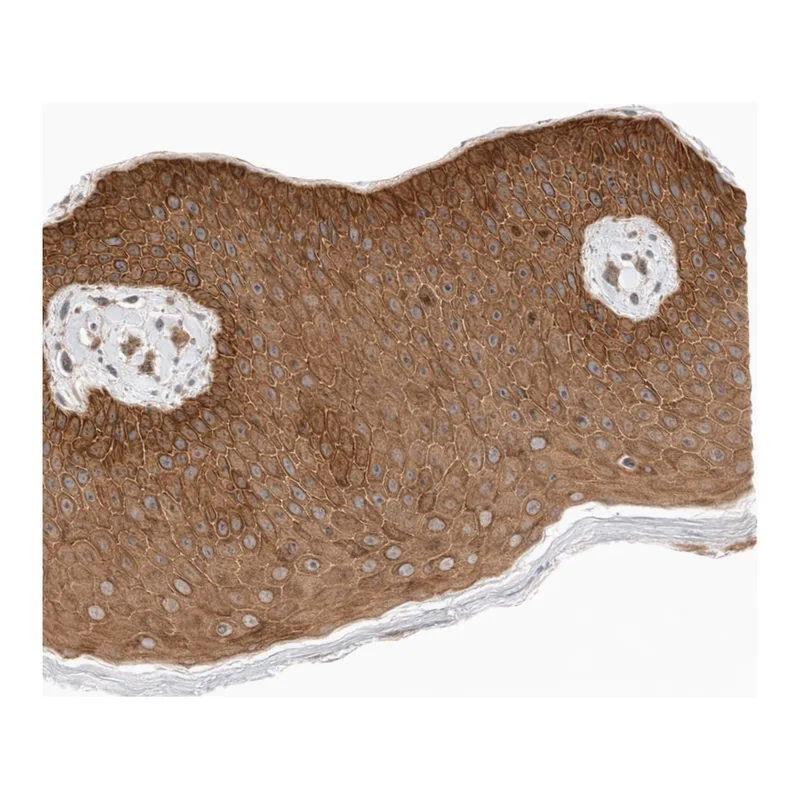 Atlas Antibodies Anti-ARMC9 Antibody