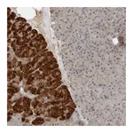 Atlas Antibodies Anti-ARMC7 Antibody