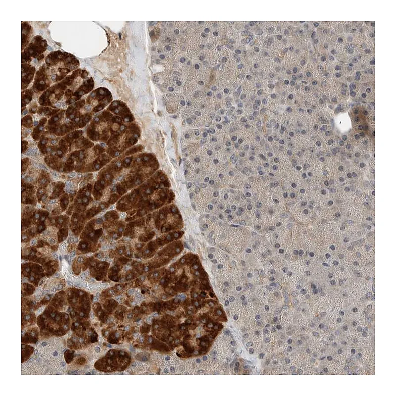 Atlas Antibodies Anti-ARMC7 Antibody