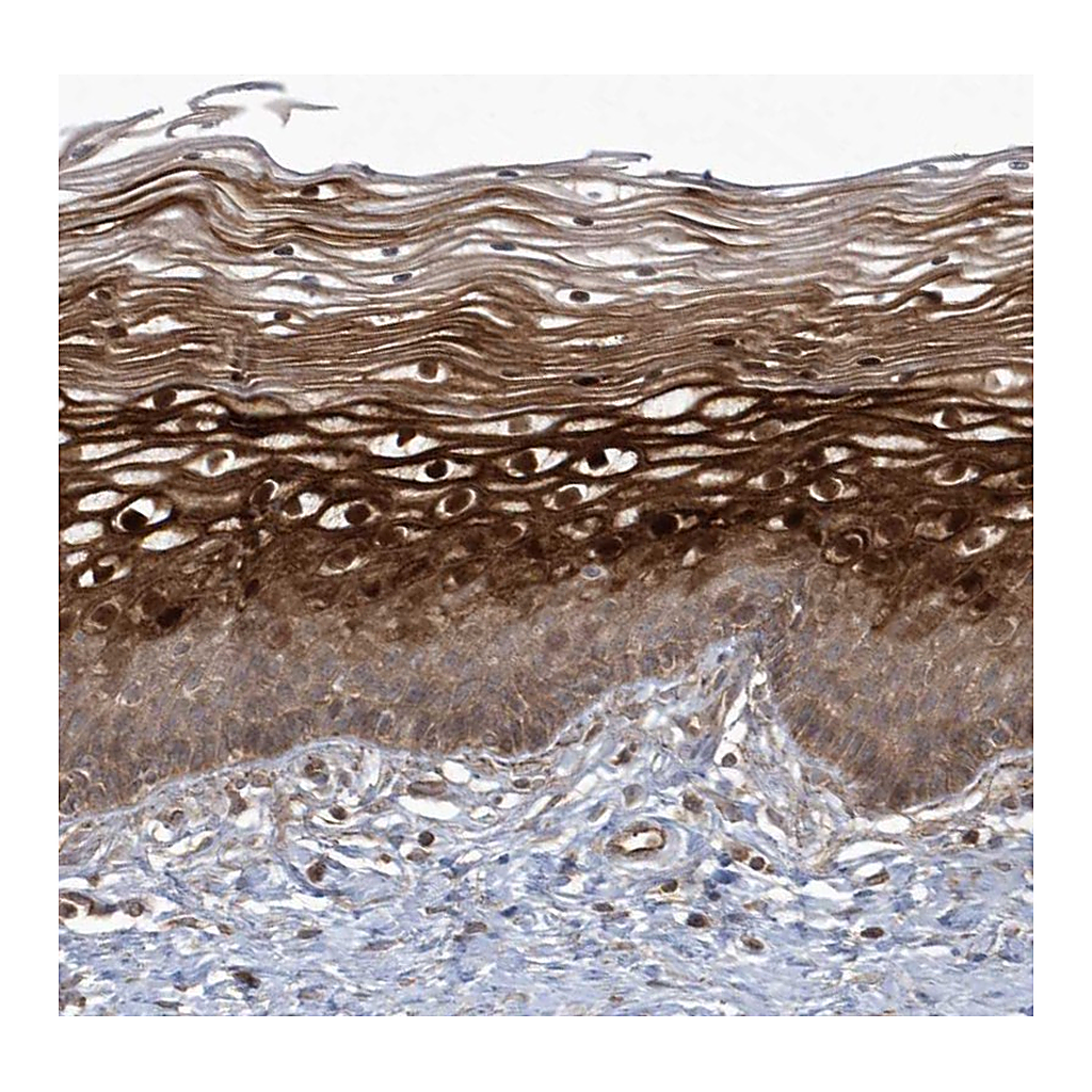 Atlas Antibodies Anti-ARMC8 Antibody