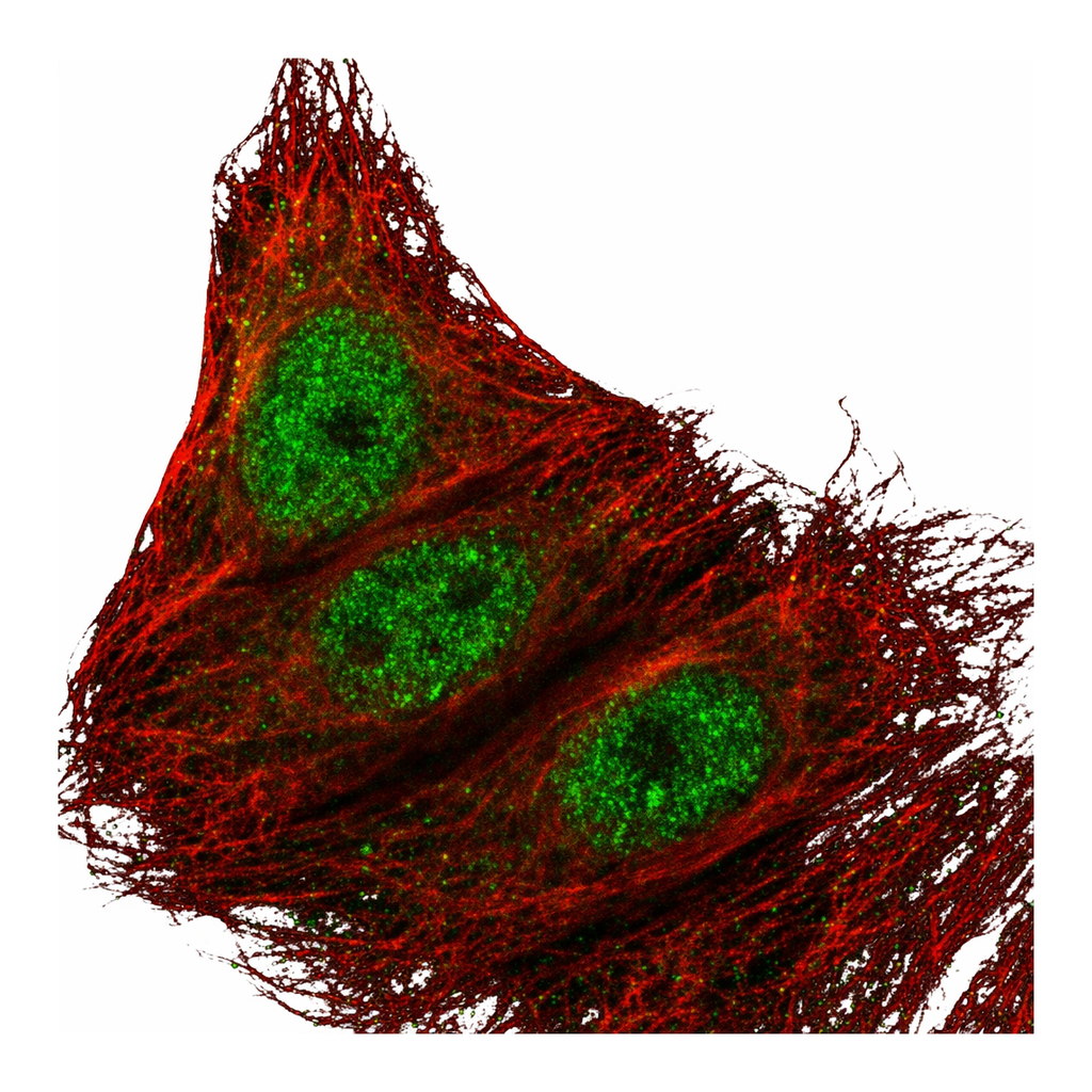 Atlas Antibodies Anti-ARMC5 Antibody