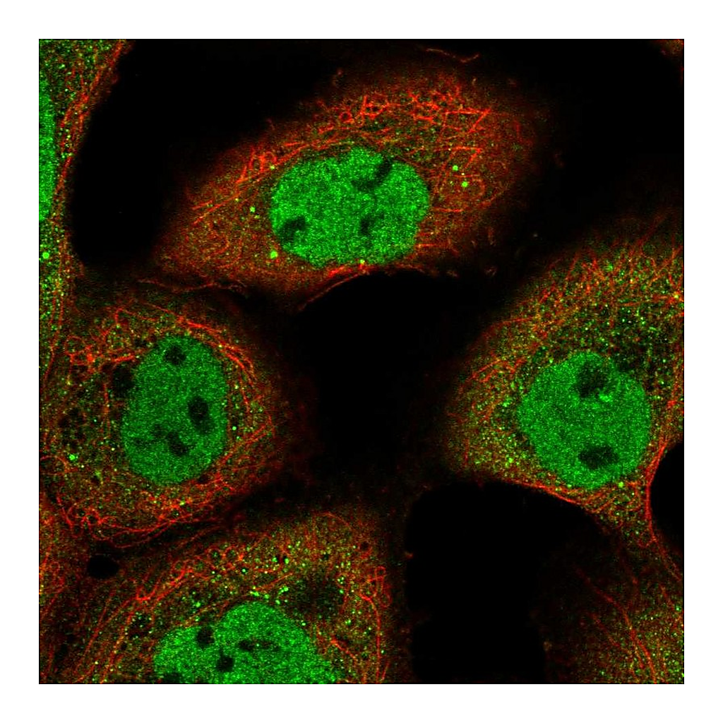 Atlas Antibodies Anti-ARMC8 Antibody