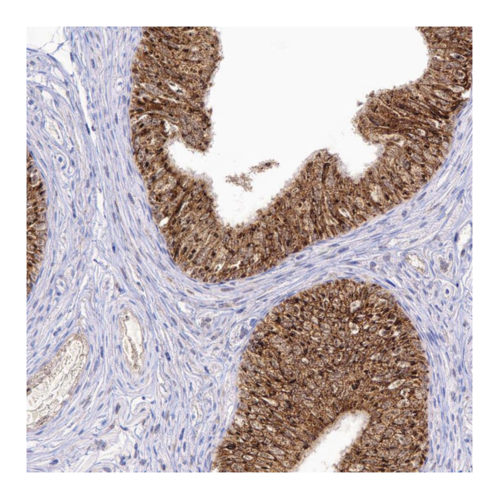 Atlas Antibodies Anti-ARMCX3 Antibody
