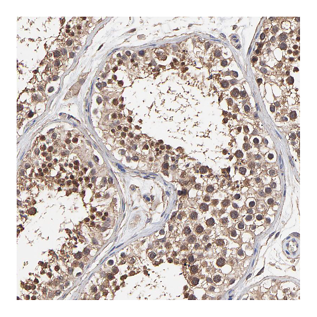 Atlas Antibodies Anti-ARMT1 Antibody