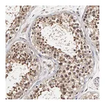 Atlas Antibodies Anti-ARMT1 Antibody