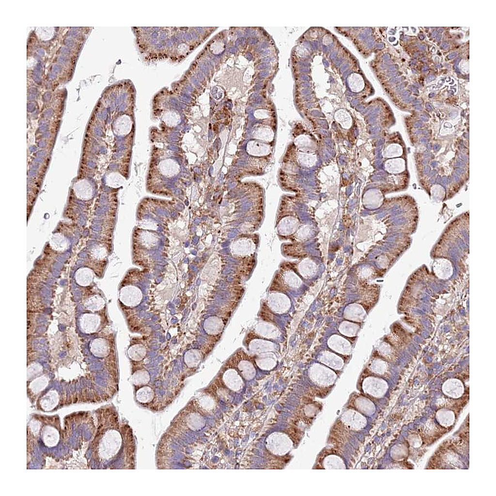 Atlas Antibodies Anti-ARMCX6 Antibody