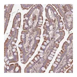 Atlas Antibodies Anti-ARMCX6 Antibody