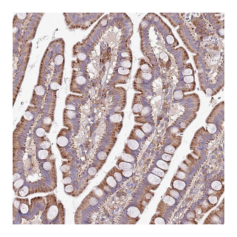 Atlas Antibodies Anti-ARMCX6 Antibody