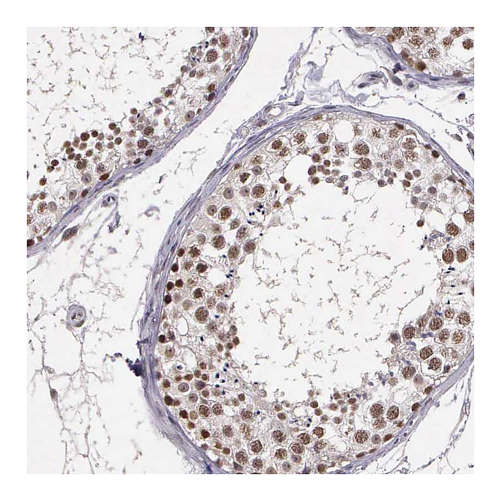 Atlas Antibodies Anti-ARMCX5 Antibody