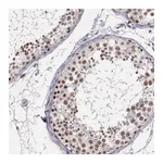 Atlas Antibodies Anti-ARMCX5 Antibody