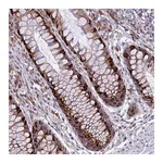Atlas Antibodies Anti-ARMCX6 Antibody