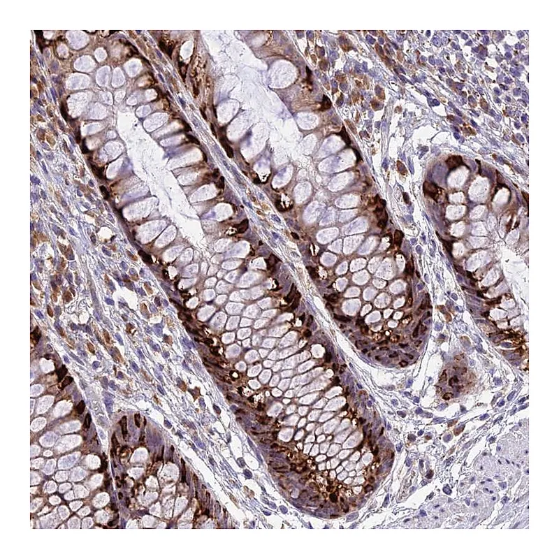 Atlas Antibodies Anti-ARMCX6 Antibody