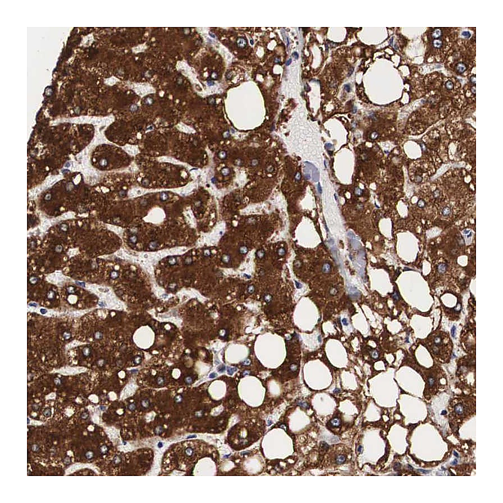 Atlas Antibodies Anti-ARMCX3 Antibody