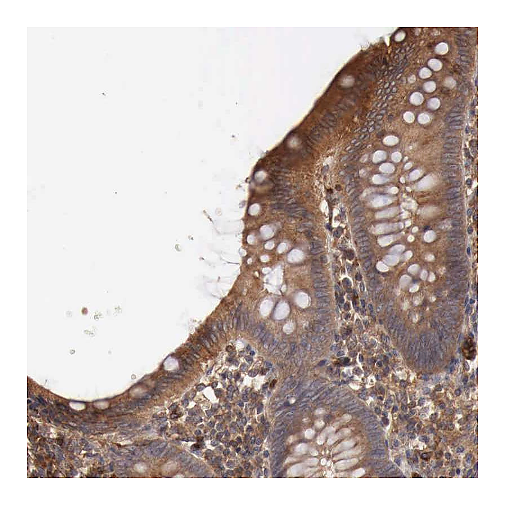 Atlas Antibodies Anti-ARMCX4 Antibody