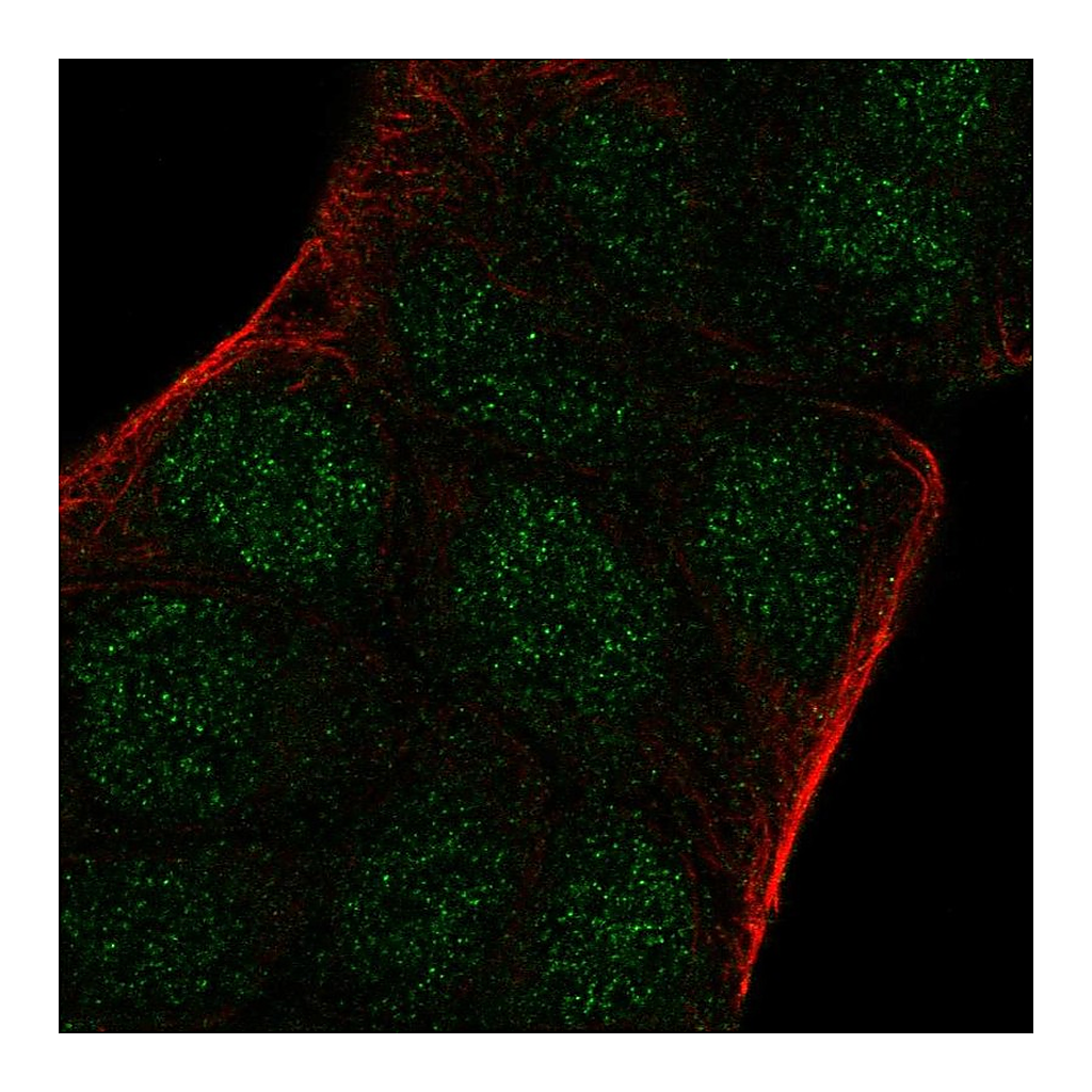 Atlas Antibodies Anti-ARNT2 Antibody