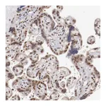 Atlas Antibodies Anti-ARNT Antibody