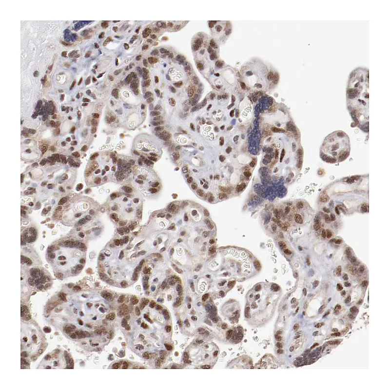 Atlas Antibodies Anti-ARNT Antibody