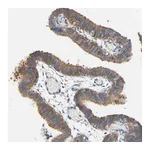 Atlas Antibodies Anti-ARPC1A Antibody