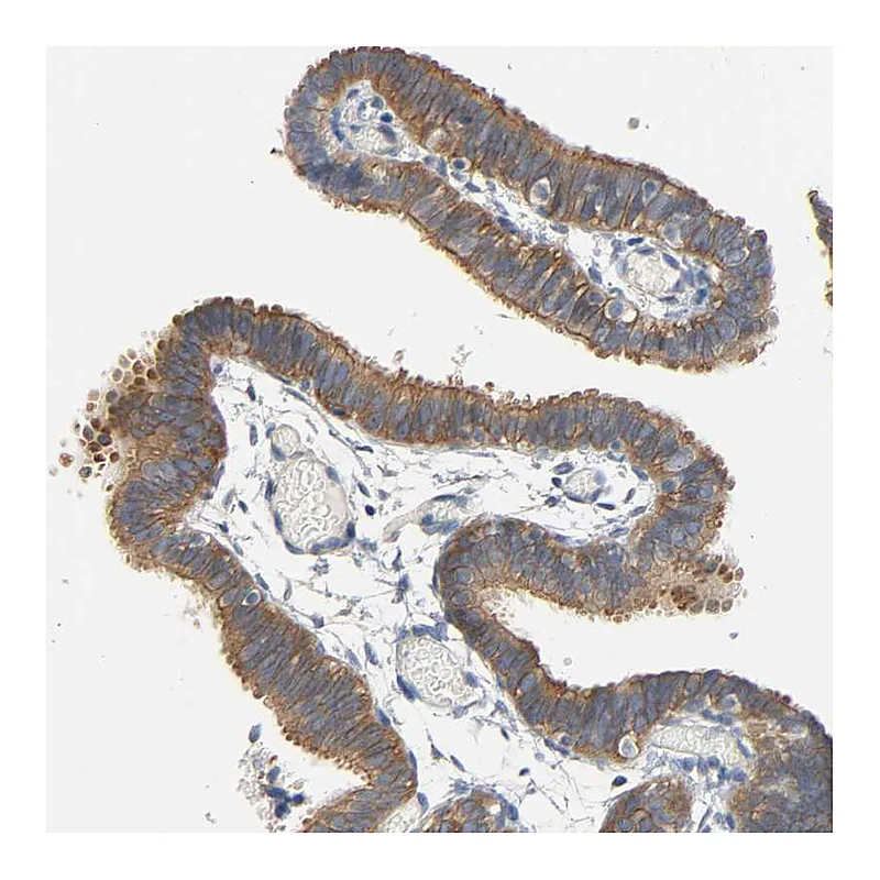 Atlas Antibodies Anti-ARPC1A Antibody