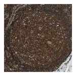 Atlas Antibodies Anti-ARPC2 Antibody
