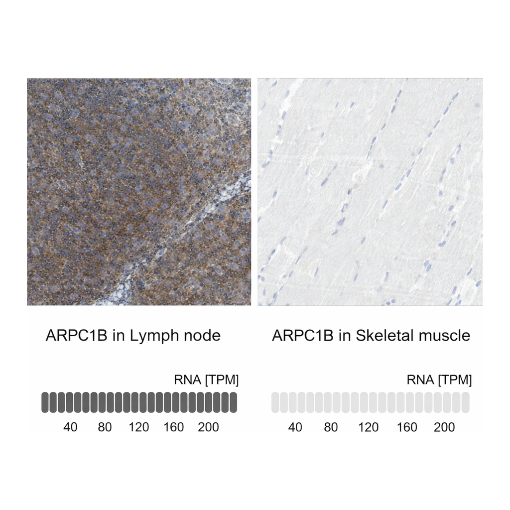 Atlas Antibodies Anti-ARPC1B Antibody