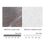 Atlas Antibodies Anti-ARPC1B Antibody