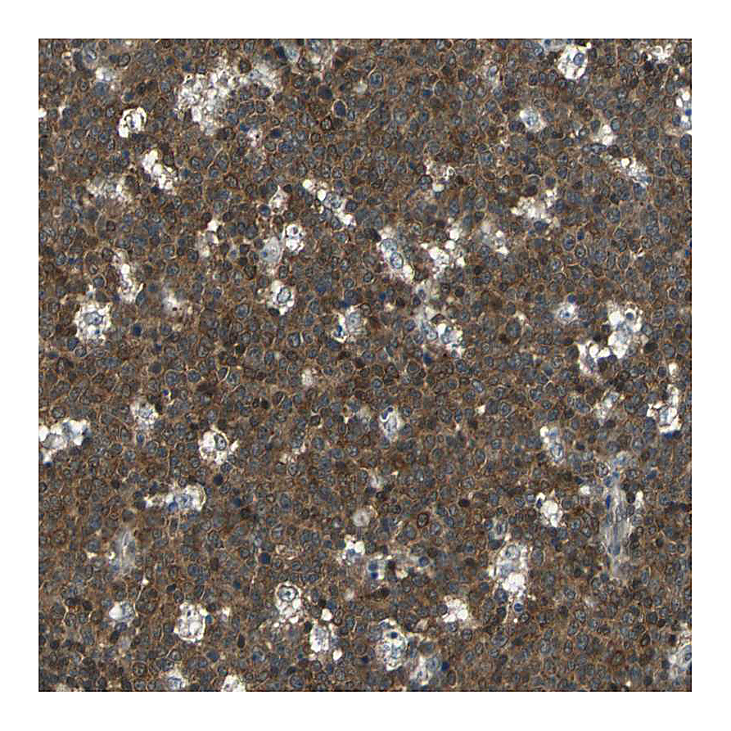 Atlas Antibodies Anti-ARPC3 Antibody