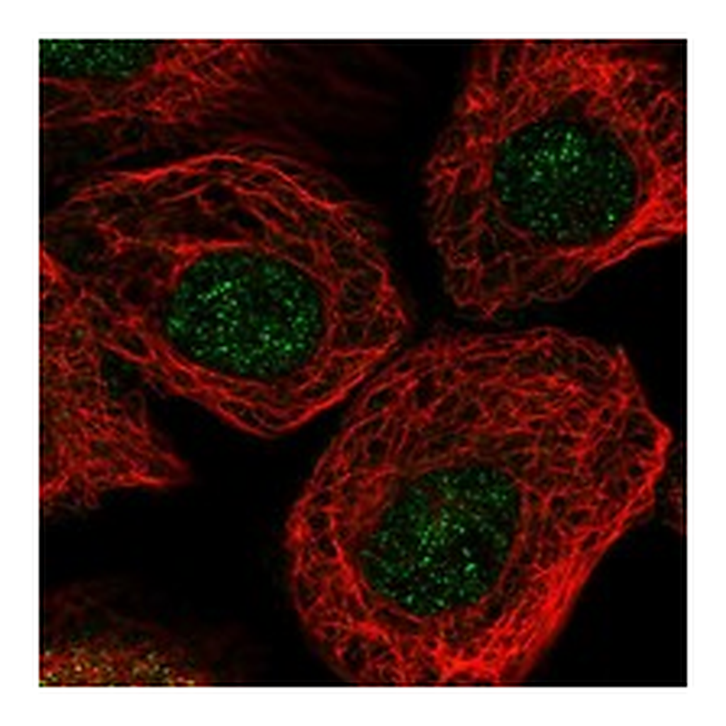 Atlas Antibodies Anti-ARPC2 Antibody