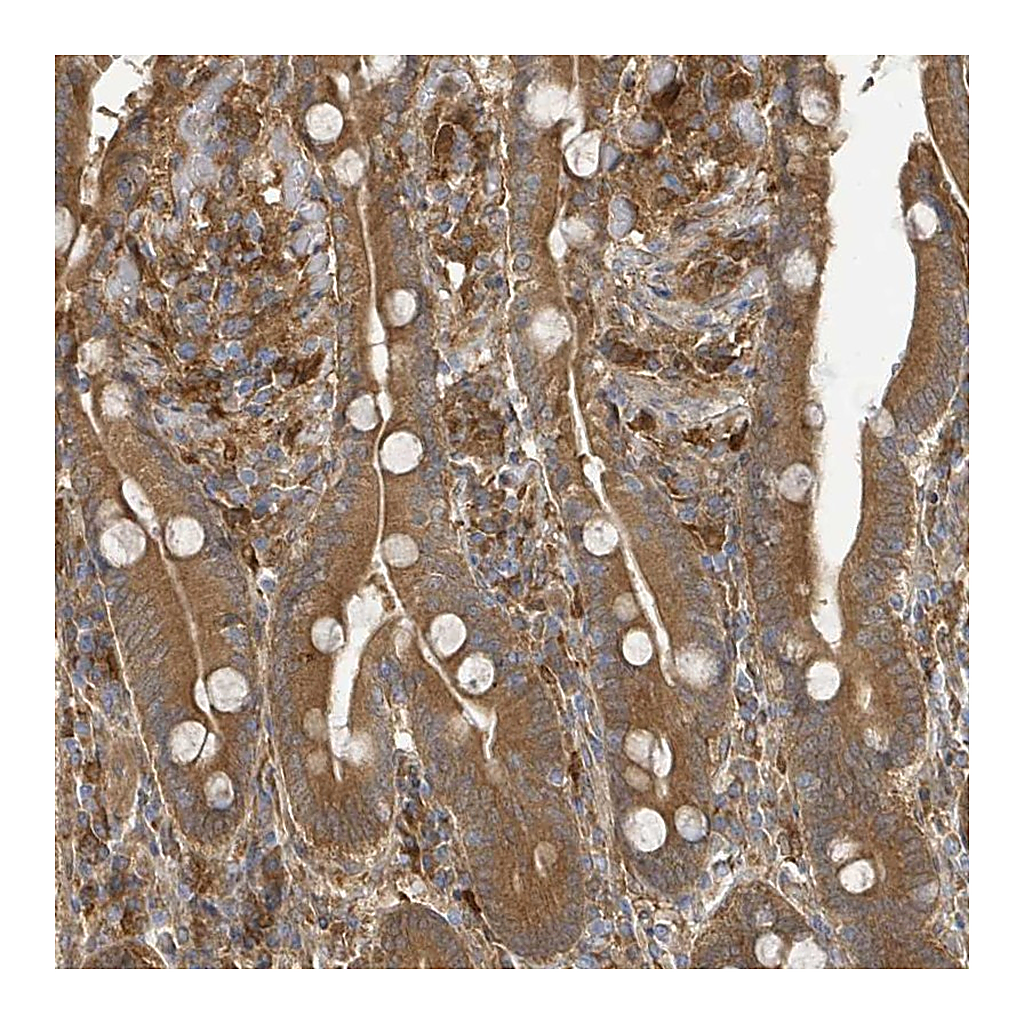 Atlas Antibodies Anti-ARPIN Antibody