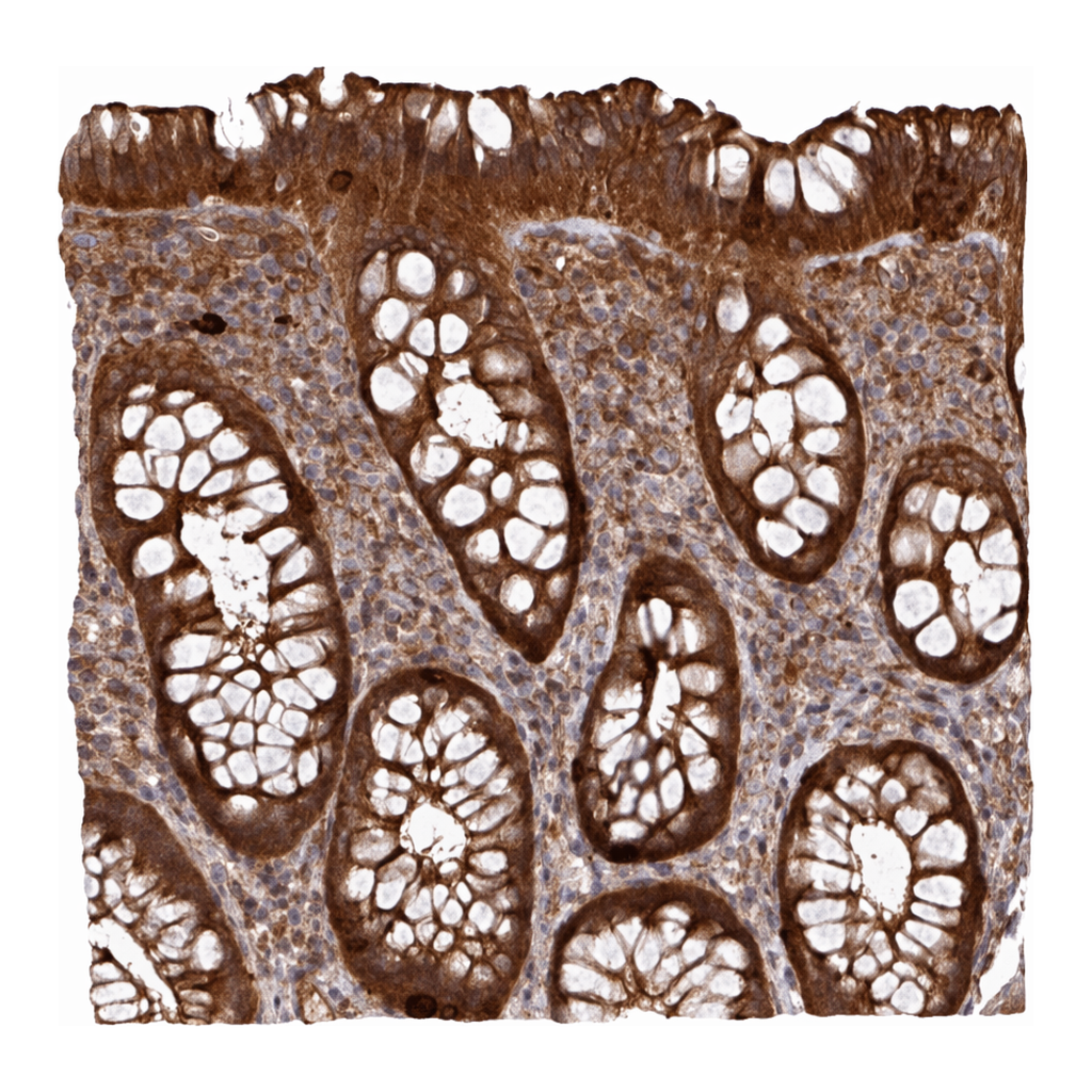 Atlas Antibodies Anti-ARPIN Antibody