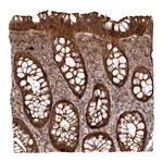 Atlas Antibodies Anti-ARPIN Antibody