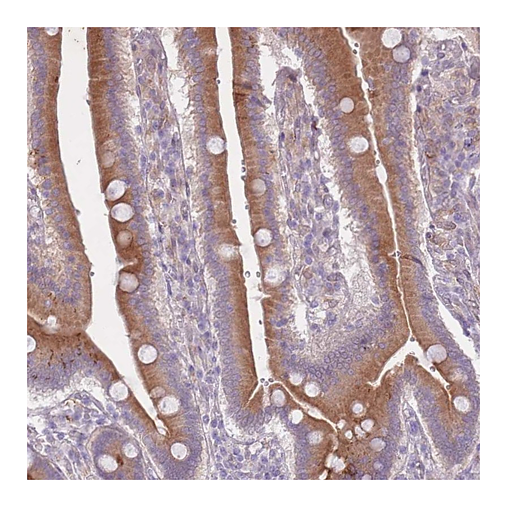 Atlas Antibodies Anti-ARPIN Antibody