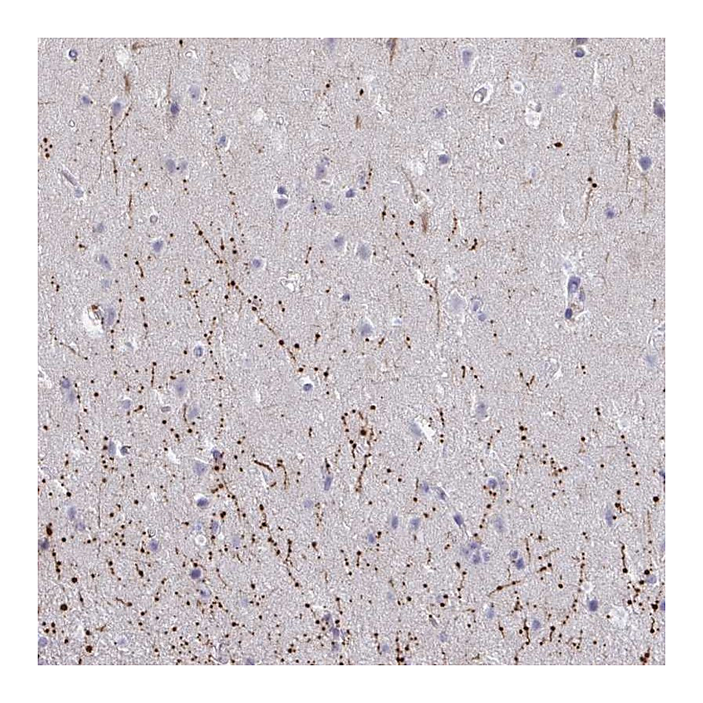 Atlas Antibodies Anti-ARPP19 Antibody