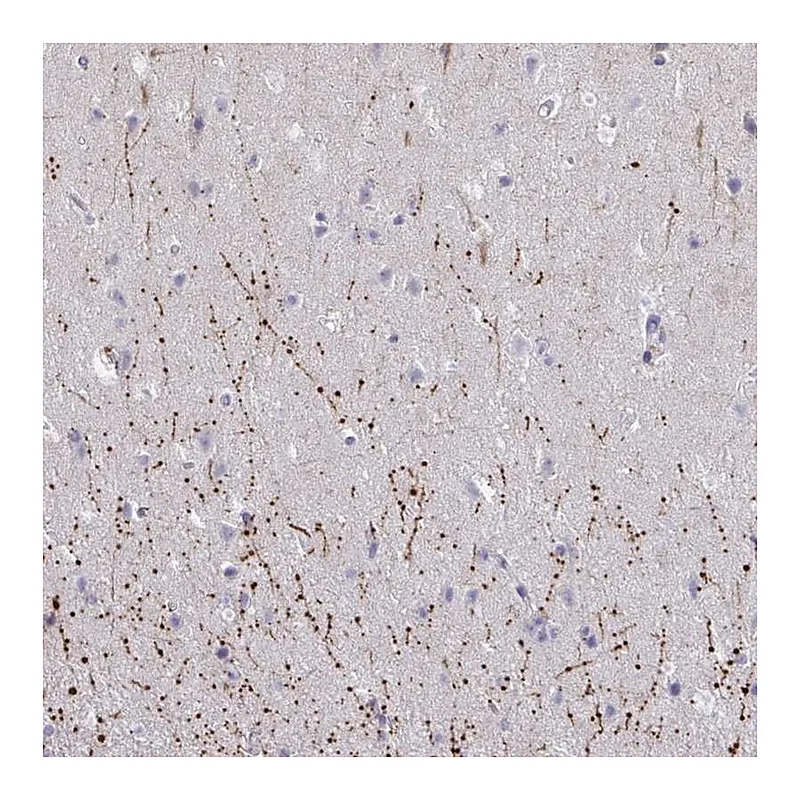 Atlas Antibodies Anti-ARPP19 Antibody