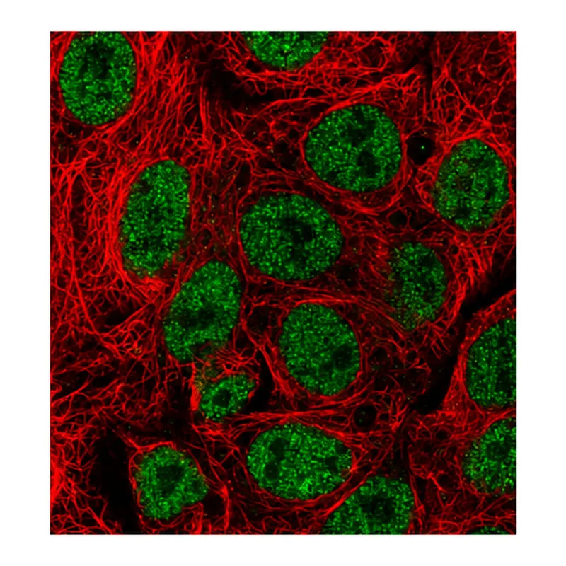 Atlas Antibodies Anti-ARRB1 Antibody