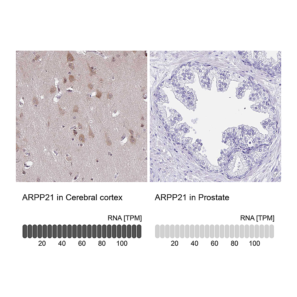 Atlas Antibodies Anti-ARPP21 Antibody