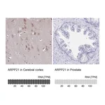 Atlas Antibodies Anti-ARPP21 Antibody
