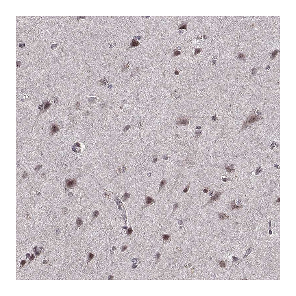 Atlas Antibodies Anti-ARRB1 Antibody