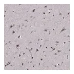 Atlas Antibodies Anti-ARRB1 Antibody