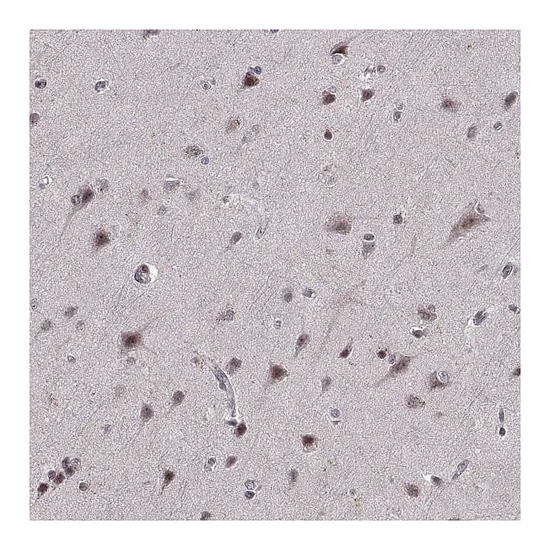 Atlas Antibodies Anti-ARRB1 Antibody