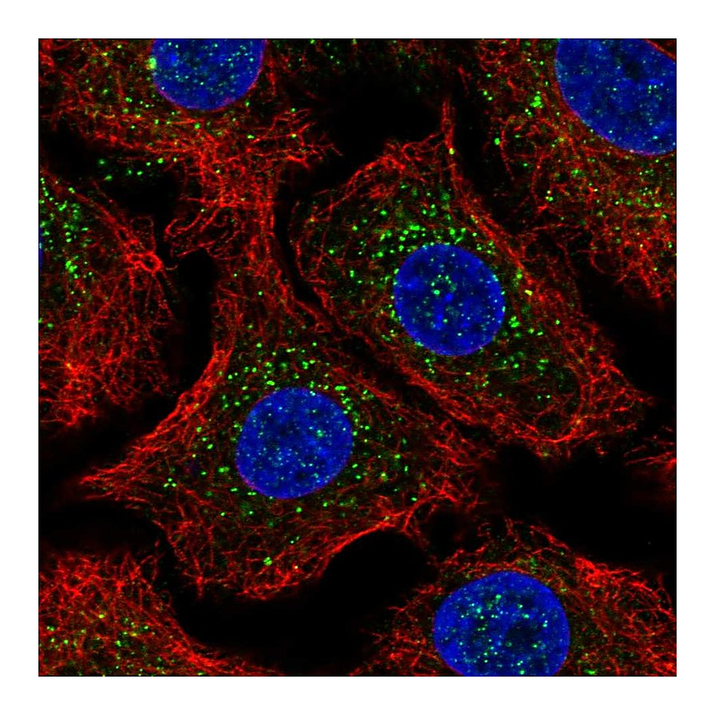 Atlas Antibodies Anti-ARRB2 Antibody