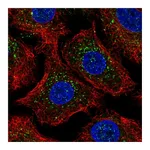 Atlas Antibodies Anti-ARRB2 Antibody