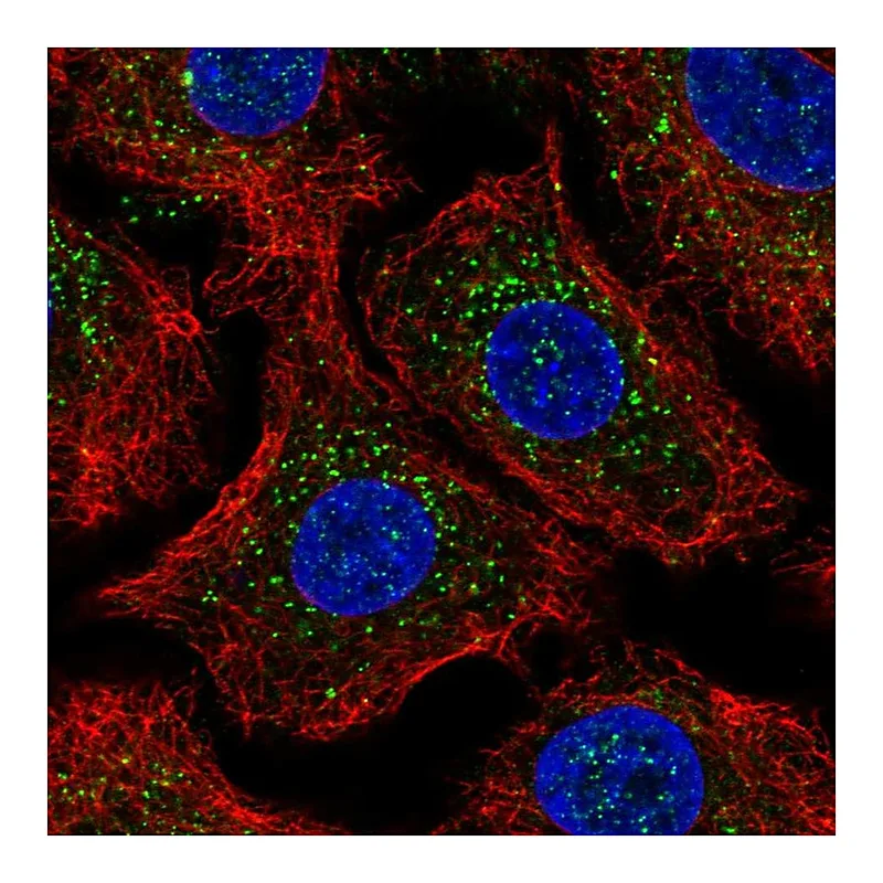 Atlas Antibodies Anti-ARRB2 Antibody